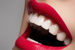 Dokonalé zuby čím dál více rozhodují o úspěchu v našem osobním i profesním životě.