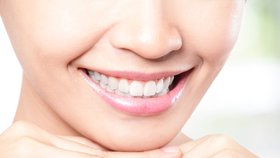Vybělte si zuby: Babské rady, které používají i modelky