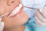 Co ničí naše zuby?