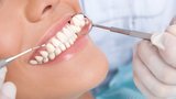 Čeští puberťáci si kazí zuby! Co nejvíce škodí zubní sklovině?