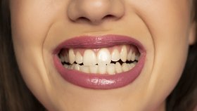 Skřípání zubů ovlivňuje jejich kvalitu.