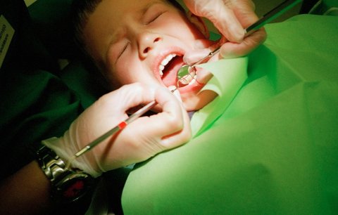 Choďte s dětmi k zubaří! Kaz číhá i v »mlíčňácích«!