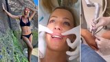 Zuzana Belohorcová zpátky na Slovensku: Tři estetické zákroky za dva týdny!
