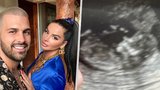 Manžel těhotné královny Instagramu Plačkové: Ukázal fotku z ultrazvuku!