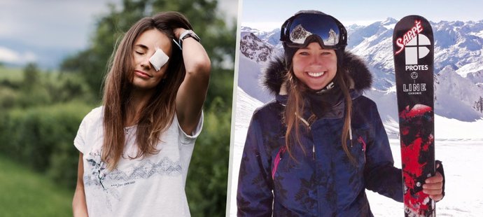 Slovenská akrobatická lyžařka Zuzana Bernardová, rozená Stromková, přišla o jedno oko.