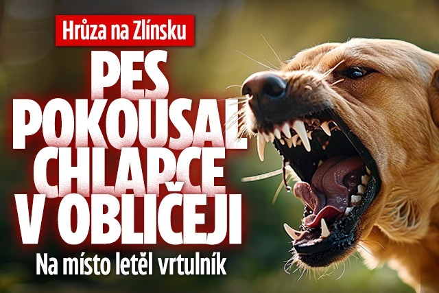 Banner ke žhavému tématu: Pes na Zlínsku pokousal chlapce v ...