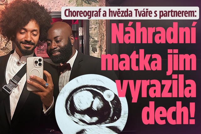 Banner ke žhavému tématu: Hvězda Tváře s partnerem: Náhradní ...