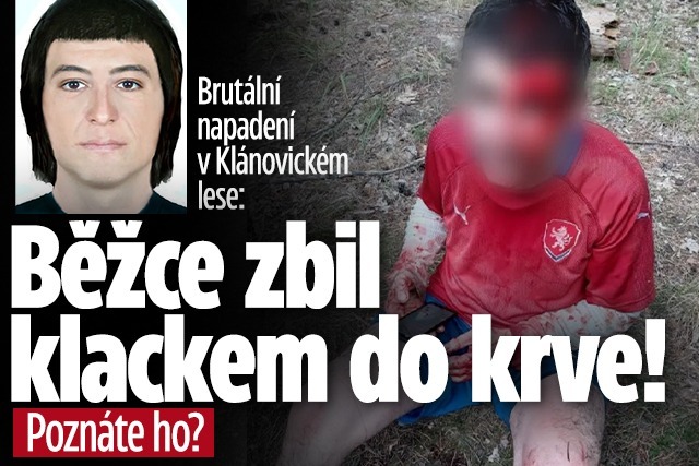 Banner ke žhavému tématu: Běžce v Klánovickém lese zbil agresor ...