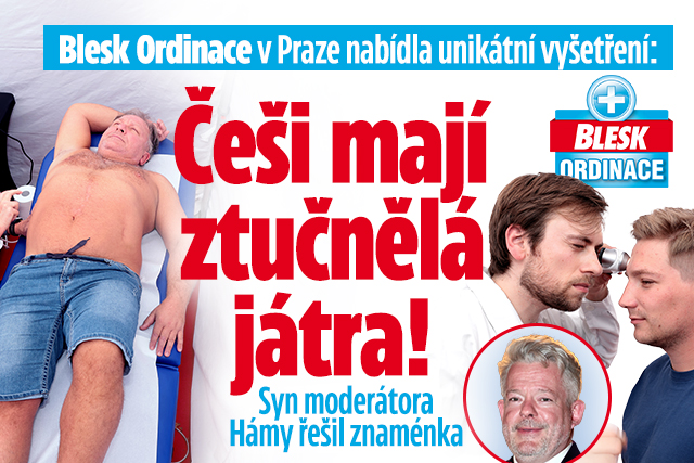 Blesk Ordinace v Praze: Češi mají ztučnělá játra!