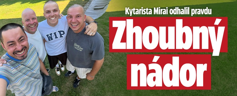Banner ke žhavému tématu: Kytarista Mirai odhalil pravdu: Zhoubný ...