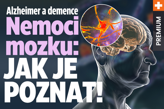 Lékaři varují: Nemocných s demencí bude o 40 % více!